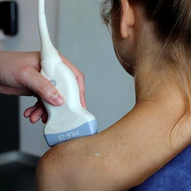 Esecuzione di un'ecografia alla spalla con sonda e gel, senza ago
